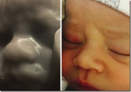 Procreate 4D permet d’imprimer votre foetus en 3D