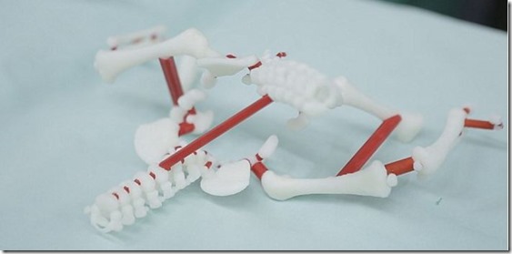 Une imprimante 3D aide à la séparation de jumeaux siamois