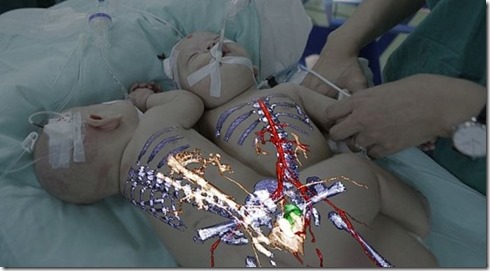 3d-siamois2