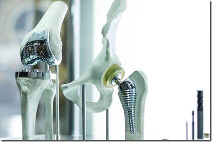 L’impression 3D vient en aide à nos genoux