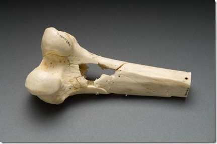 L’impression 3D bientôt utilisée pour lutter contre le cancer