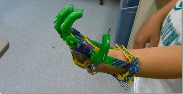 Des adolescents fabriquent une main imprimée à un amputé