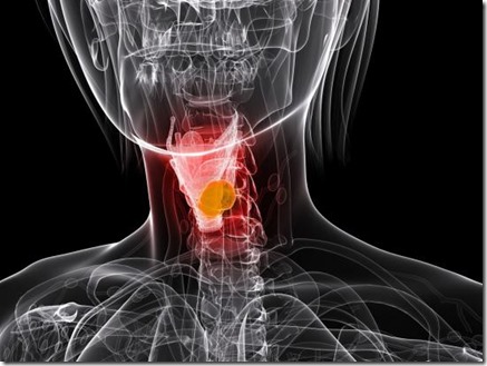 Un homme sauvé par des implants imprimés en 3D